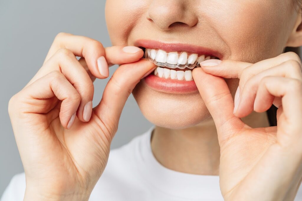 Woman using a teeth whitening tray